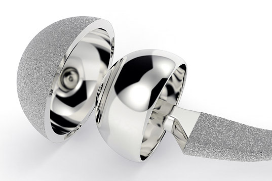 Hip Joint Implant 3-2