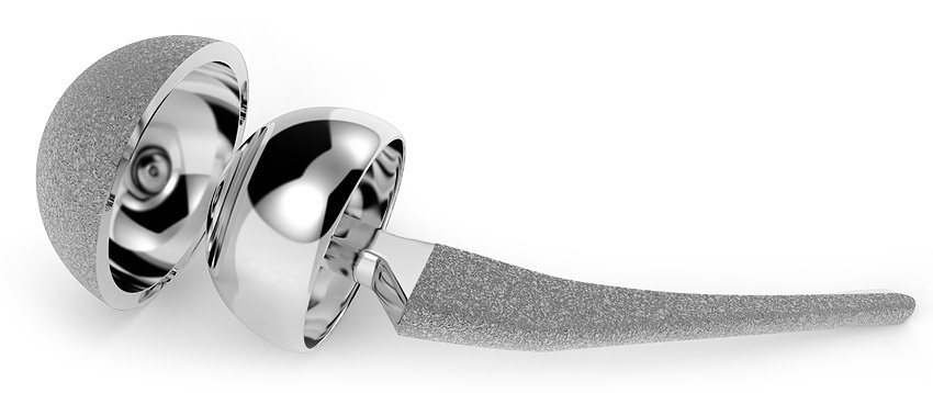 Hip Joint Implant
